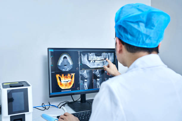 Best Emergency Care for Gum Disease in South Bend, WA
